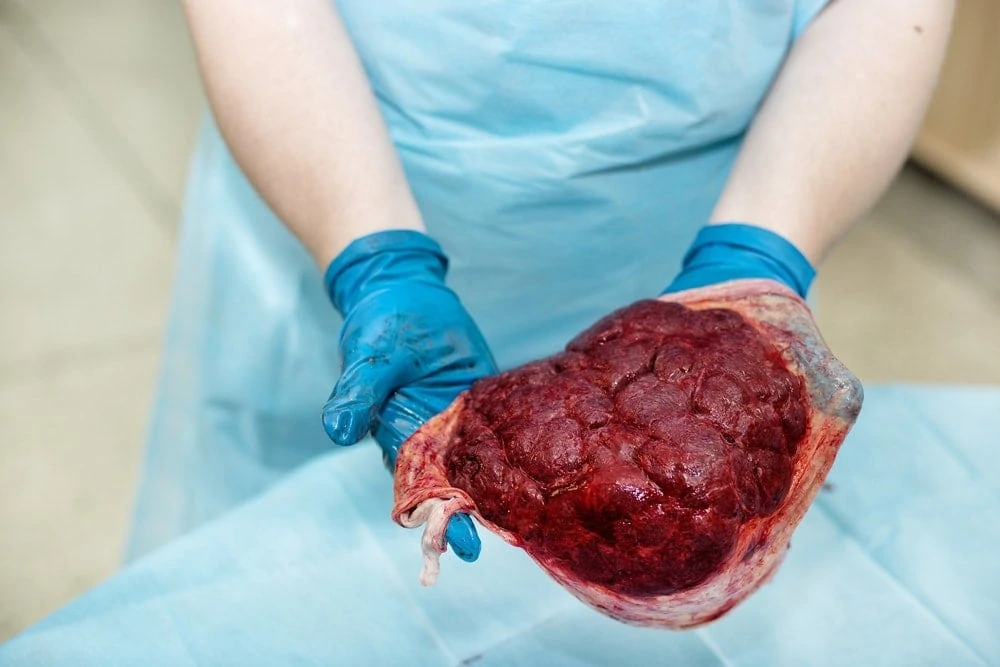 Placental Encapsulation